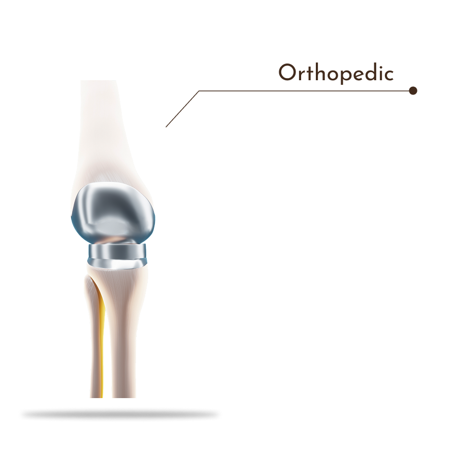 Orthopedic knee prosthesis used in joint replacement surgery